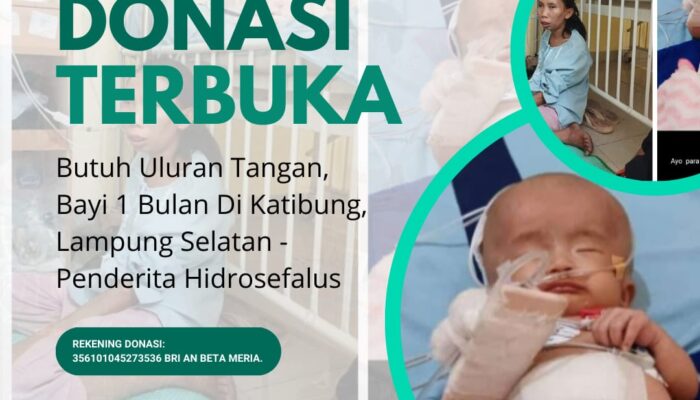 Butuh Uluran Tangan, Bayi 1 Bulan Di Katibung Penderita Hidrosefalus