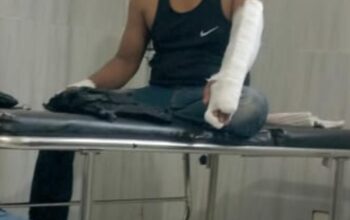 Patah Tulang, Tanpa Itikad Baik: Jurnalis Cilacap Tempuh Jalur Hukum